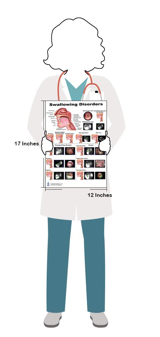 Swallow Disorders Anatomy Poster 12X17Inch, Dysphagia Endoscopic View-Oral Phase Disorders-Nasal Regurgitation