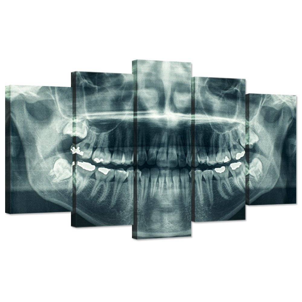Ihappywall Modern 5 Panel Canvas Wall Art X-Ray Dental Tooth Oral Panoramic The Picture Teeth Decay Print For Dental Room Stretc