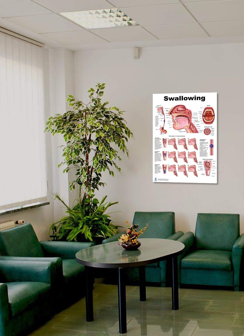 Blue Tree Publishing Swallowing Anatomy Education (24 X 36 Inch)
