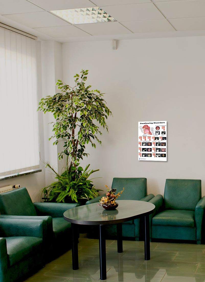 Swallow Disorders Anatomy Poster 12X17Inch, Dysphagia Endoscopic View-Oral Phase Disorders-Nasal Regurgitation