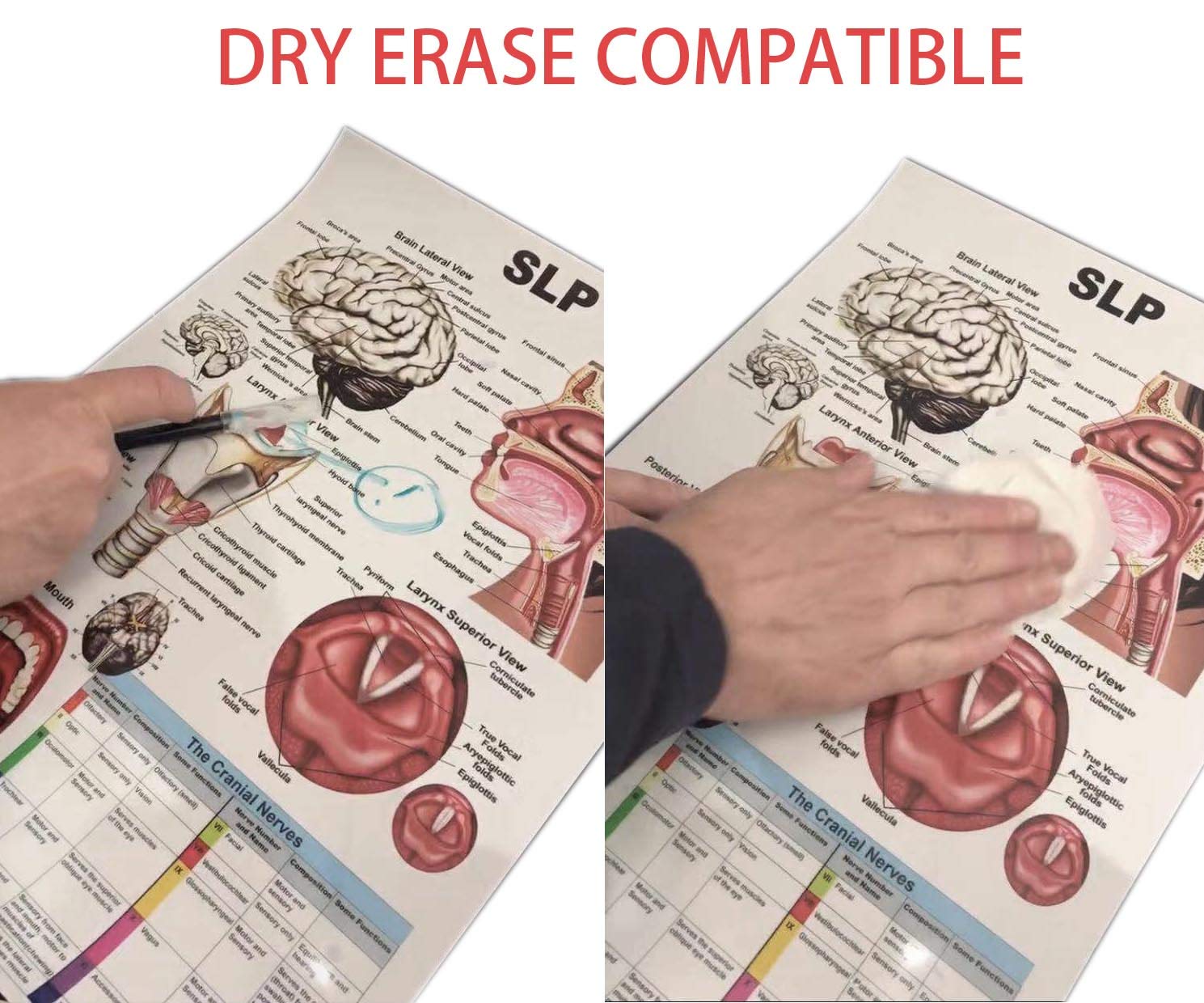 Blue Tree Publishing Ear Nose Throat Anatomy Poster 24X36Inch, Otolaryngology