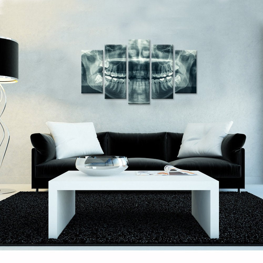 iHAPPYWALL Modern 5 Panel Canvas Wall Art X-Ray Dental Tooth Oral Panoramic The Picture Teeth Decay Print for Dental Room Stretched and Framed for Living Room Ready to Hang