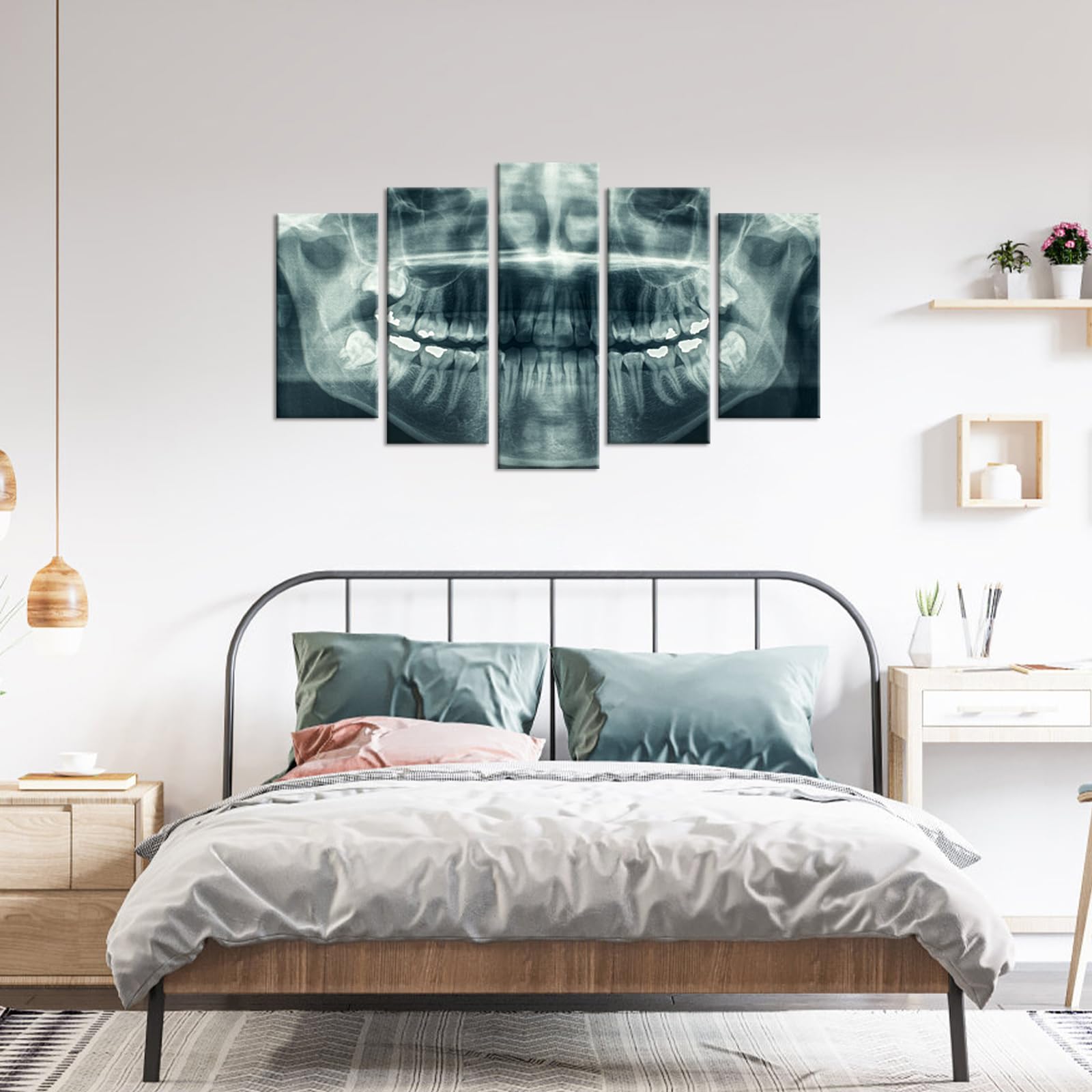 iHAPPYWALL Modern 5 Panel Canvas Wall Art X-Ray Dental Tooth Oral Panoramic The Picture Teeth Decay Print for Dental Room Stretched and Framed for Living Room Ready to Hang