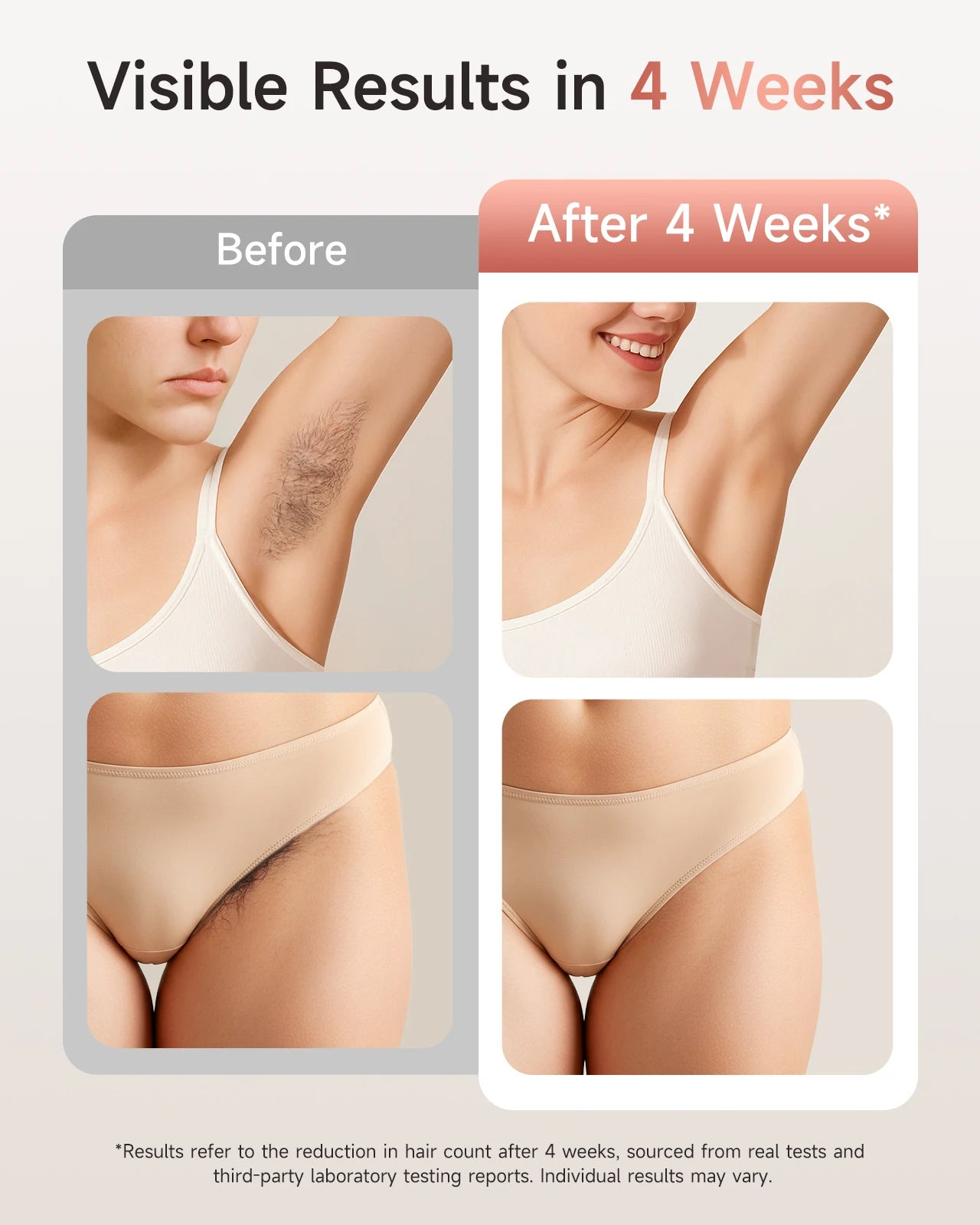 Unlimited Flashes IPL Hair Removal 9 Energy Levels Epiladora Laser with Acne Treatment for Women’s Body and Bikini Line Home Use