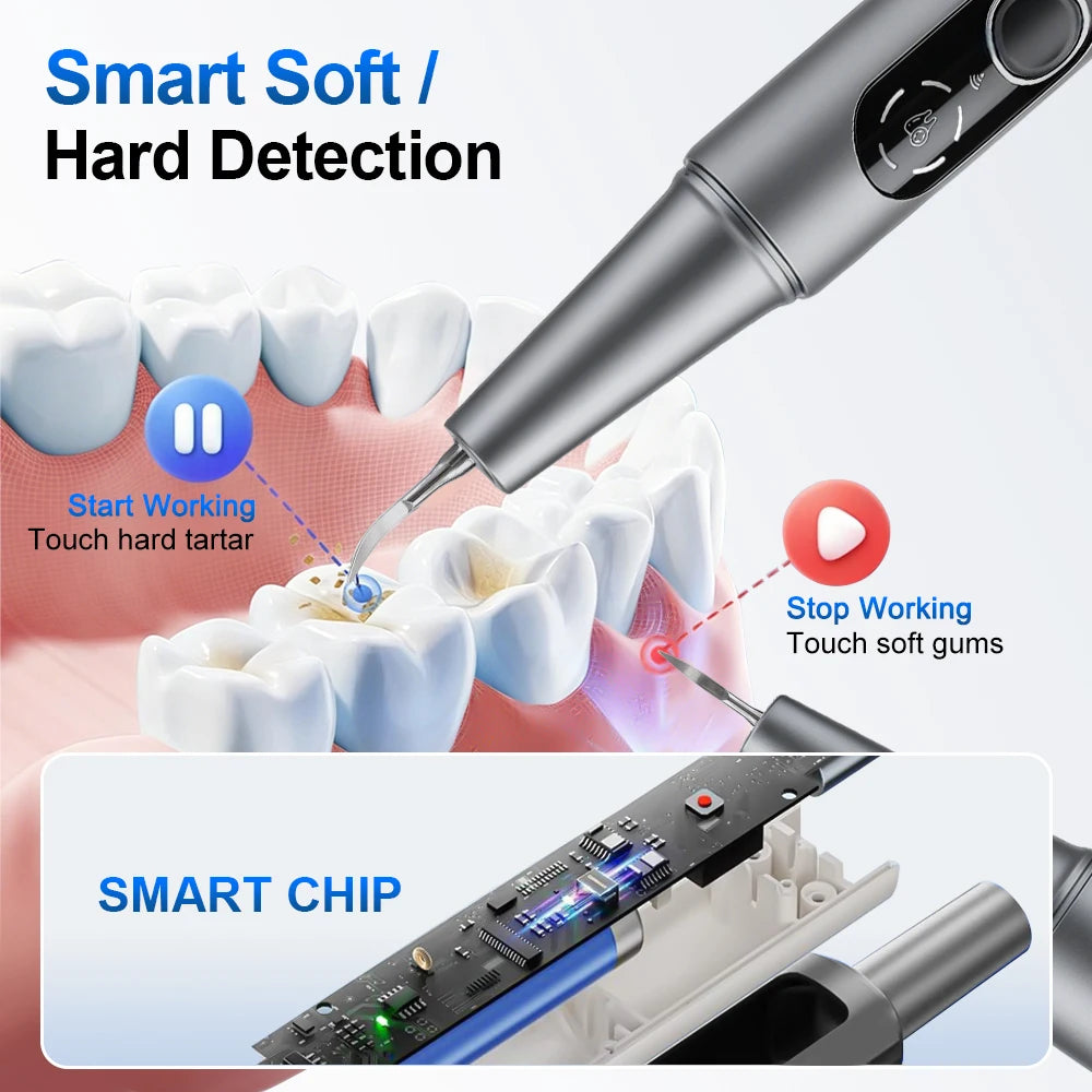 New Visual Ultrasonic Dental Scaler 500W 360°HD Camera Tooth Cleaner with LED Light Dental Stains Tartar Plaque Calculus Removal